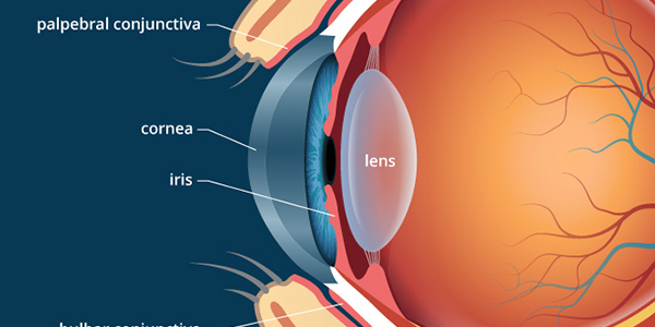Post operative lasik care